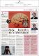 Stroke - fast action, immediate treatment.pdf.jpg