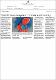 ‘Youthful’ immune system promotes autoimmunity..pdf.jpg